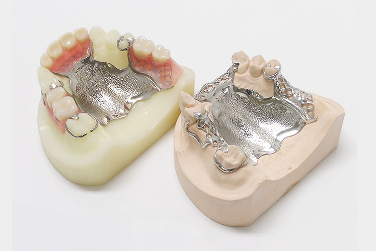 金属床義歯（コバルトクロム、チタン）のイメージ画像